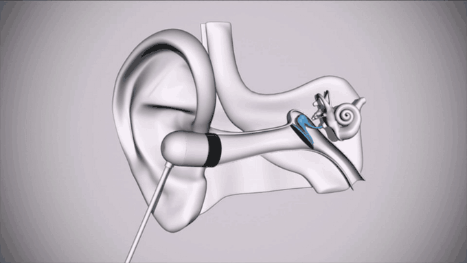 внутриканальные наушники внутри уха